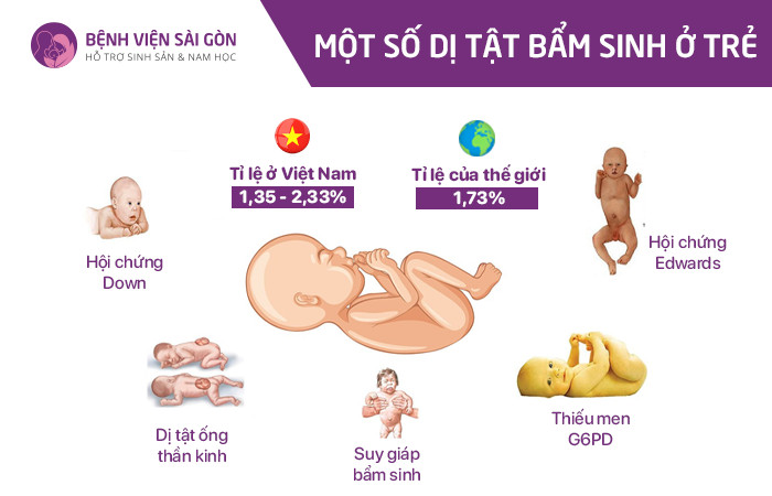 Một số dị tật bẩm sinh ở trẻ Một số dị tật bẩm sinh ở trẻ