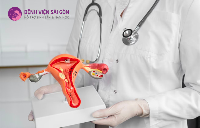 Nguyên nhân dẫn đến buồng trứng đa nang là do rối loạn nội tiết tố