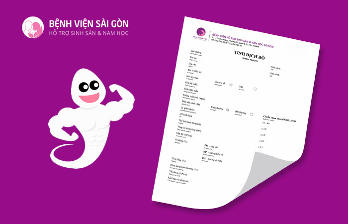 Xét nghiệm tinh dịch đồ để xác định vô tinh
