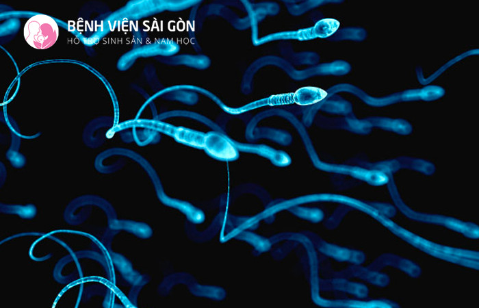 Phương pháp PESA thường được chỉ định khi người bệnh nam bị vô tinh