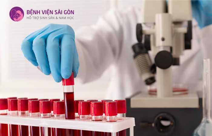 Có thể chẩn đoán đa nang buồng trứng thông qua xét nghiệm máu