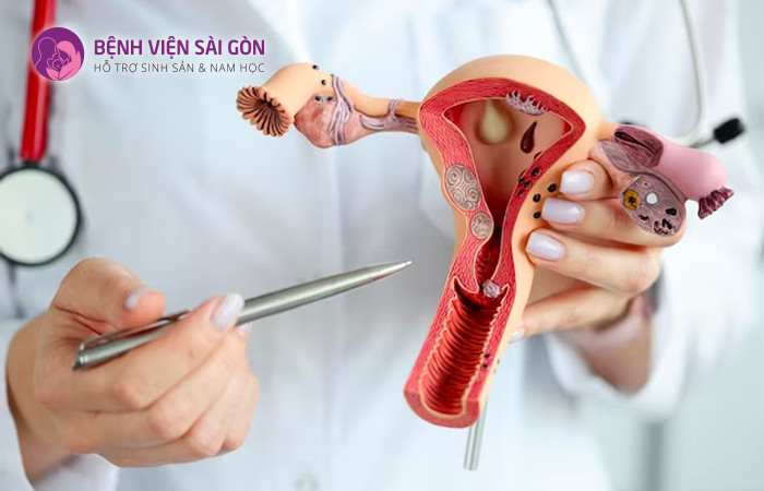Tử cung là một trong những cơ quan sinh sản quan trọng của nữ giới