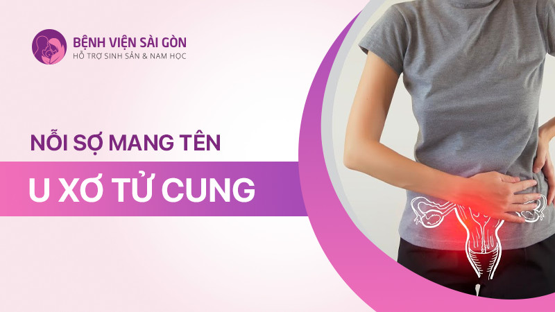 Nỗi sợ mang tên U xơ tử cung