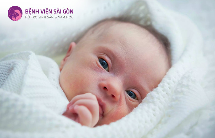 Trẻ mắc hội chứng Edwards là do như NST thứ 18