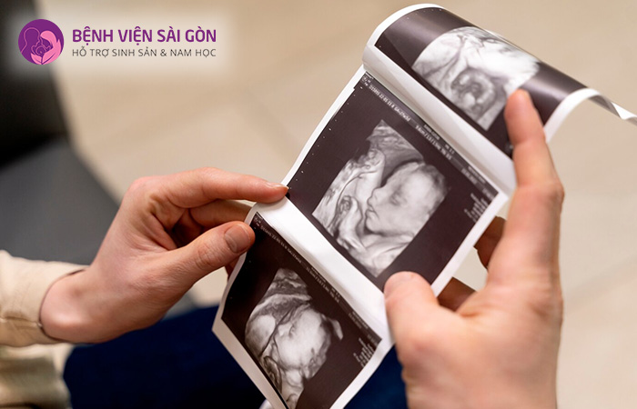 Hình ảnh siêu âm 4D