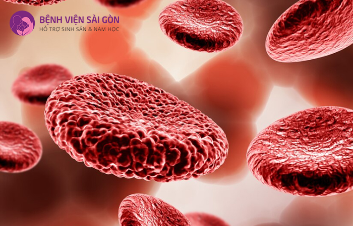 Bệnh hồng cầu hình lưỡi liềm là một dạng rối loạn di truyền gen đơn