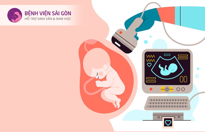 Phương pháp siêu âm có thể giúp các bác sĩ chẩn đoán tình trạng thai chết lưu