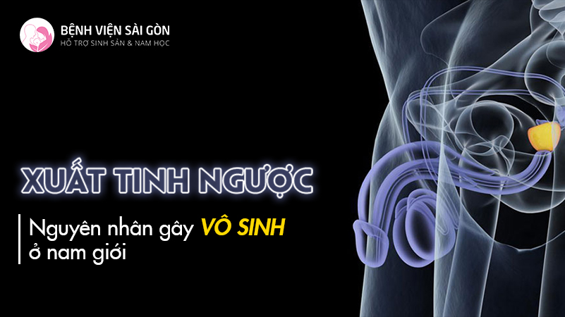 Xuất tinh ngược nguyên nhân gây vô sinh ở nam giới
