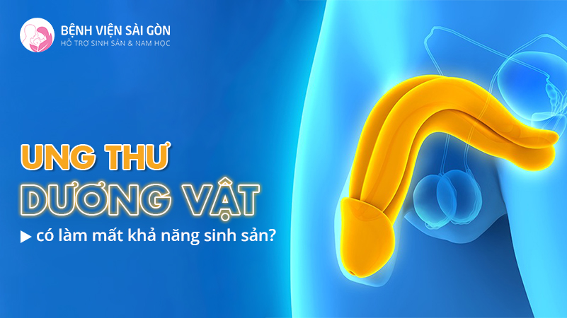 Ý nghĩa xét nghiệm tinh dịch đồ trong điều trị hiếm muộn
