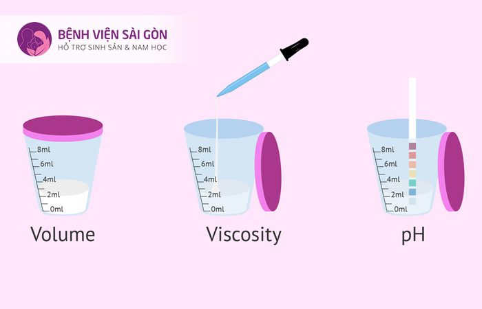 Xét nghiệm tinh dịch đồ sẽ cung cấp thông tin chi tiết số lượng, pH, màu sắc của tinh dịch