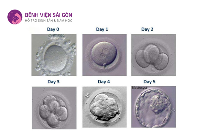 Phân loại phôi là một phần quan trọng để các bác sĩ và chuyên viên phôi học đánh giá chất lượng phôi