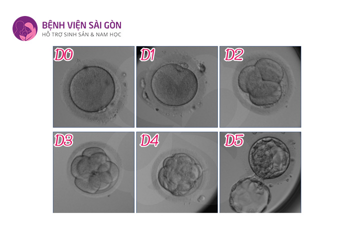 Các trung tâm hỗ trợ sinh sản ưu tiên lựa chọn chuyển phôi ngày 5 nhằm tăng tỷ lệ thành công