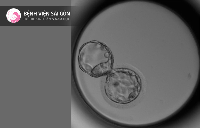 Chỉ có những phôi ngày 5 mới tiêu chuẩn để xét nghiệm di truyền tiền làm tổ