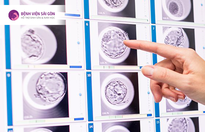 Công nghệ quan sát phôi giúp theo dõi được quá trình phát triển của phôi