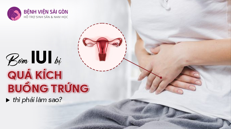 Giải đáp: Bơm IUI bị quá kích buồng trứng thì phải làm sao?