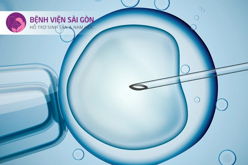 thụ tinh trong ống nghiệm thụ tinh trong ống nghiệm