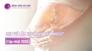 chi phí làm iui và ivf