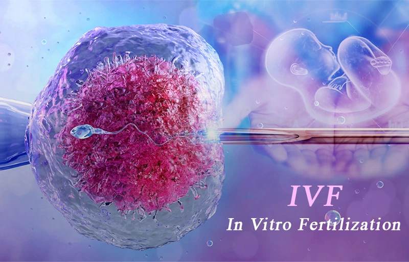 IVF là gì IVF là gì